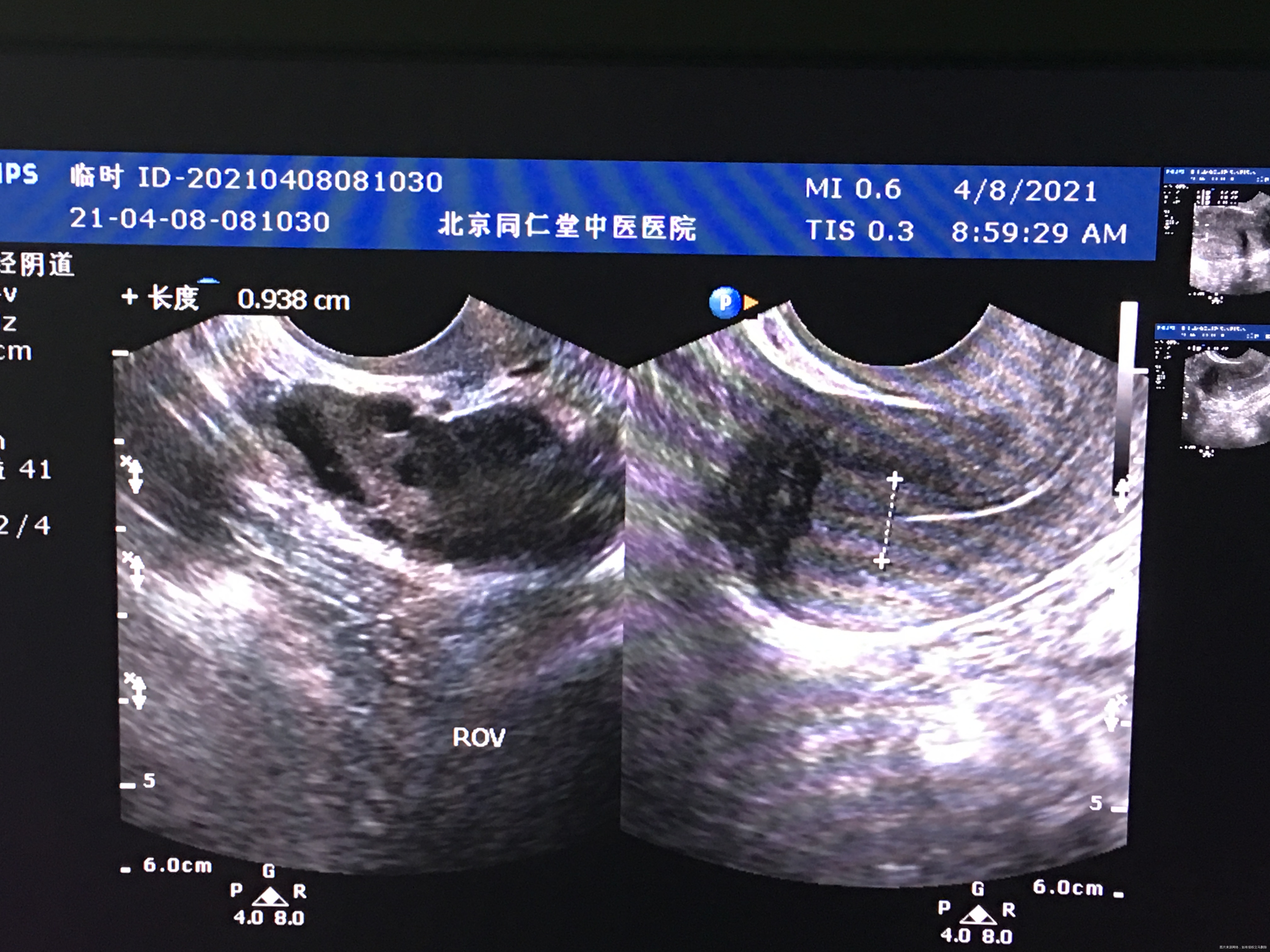 您好我月经不规律上次月经3月2日请问我现在这