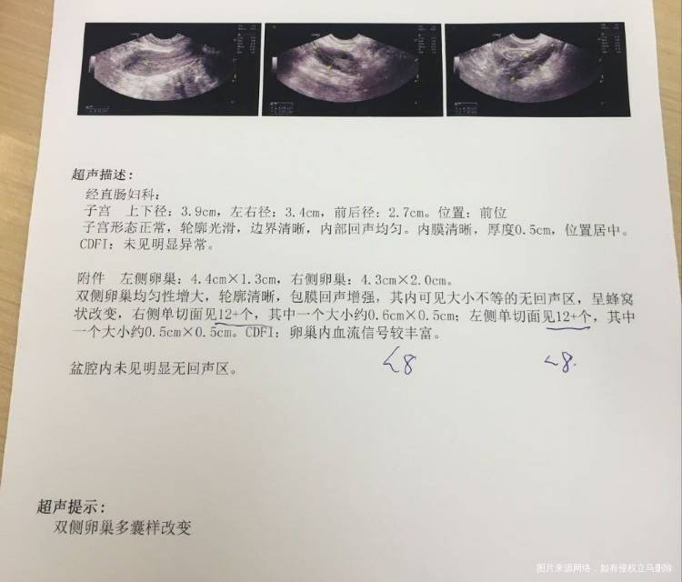没有性生活不备孕做了检查目前我不知道自己是否