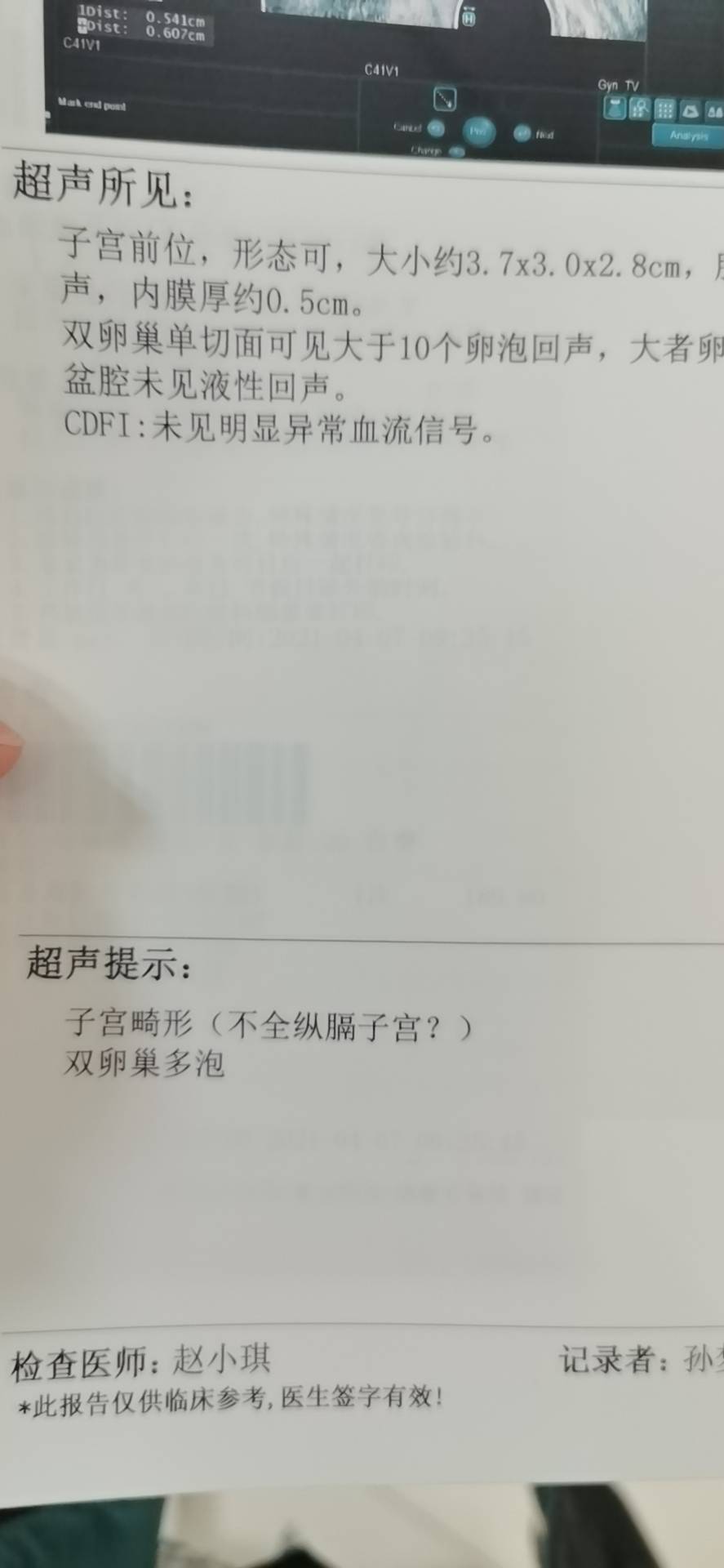 19年年底自然流产过清宫过后月经一直不正常吃