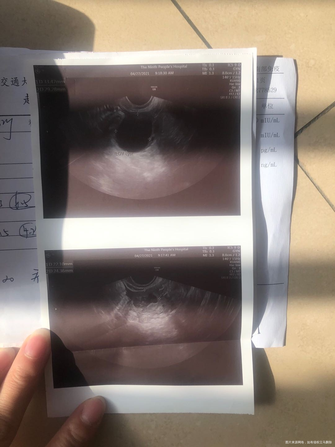 您好我这几次月经有点混乱4月8号来月经第五天