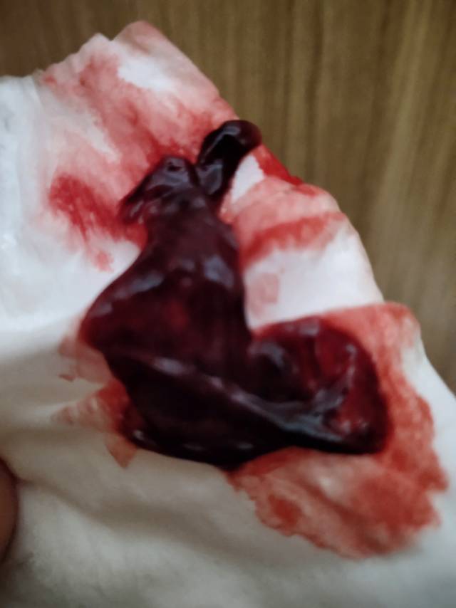 大夫您好我想一咨询一下本月备孕打了15只人体