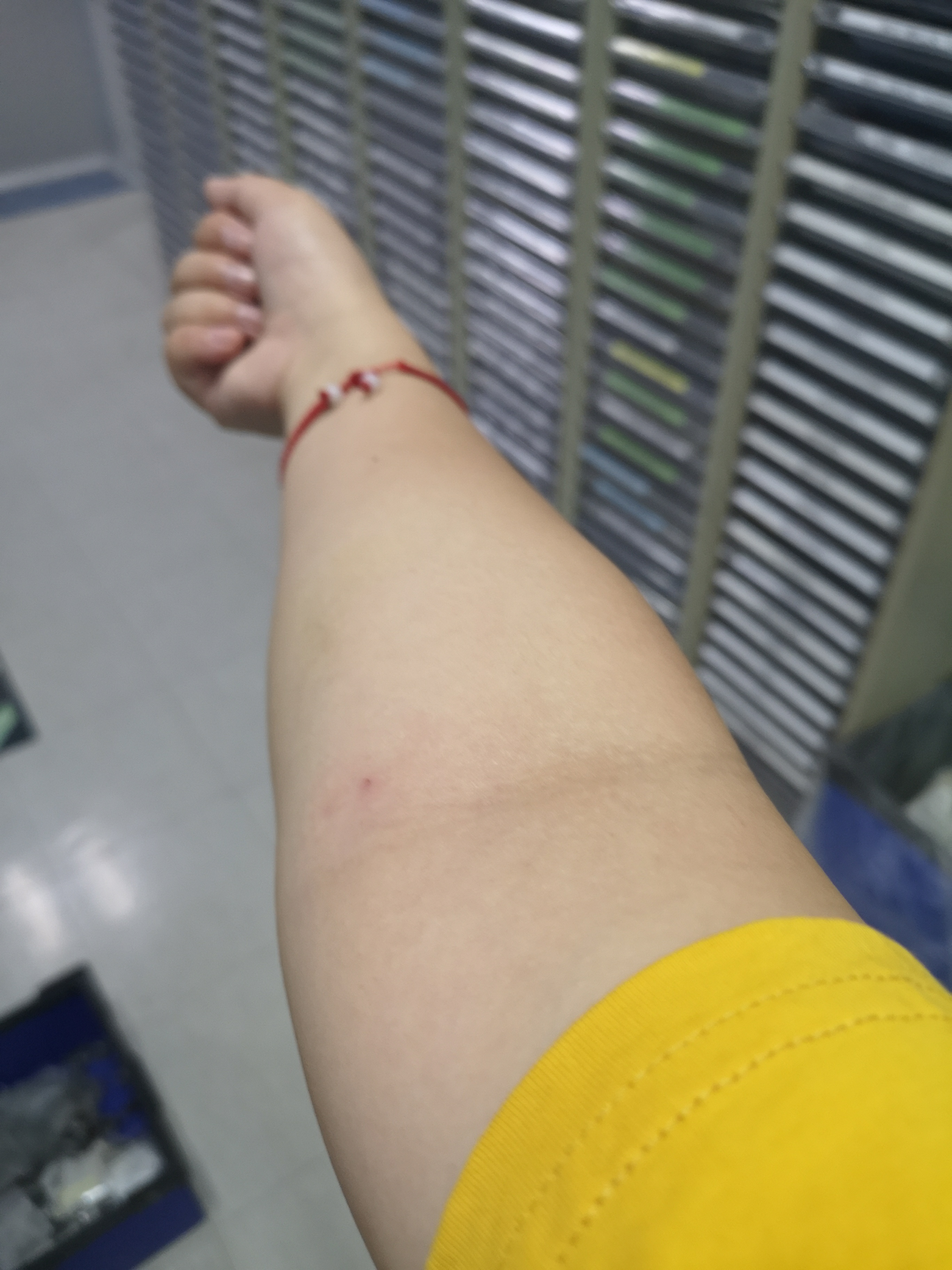 今天公司体检手臂扎针不出血还被用针头在里面搅