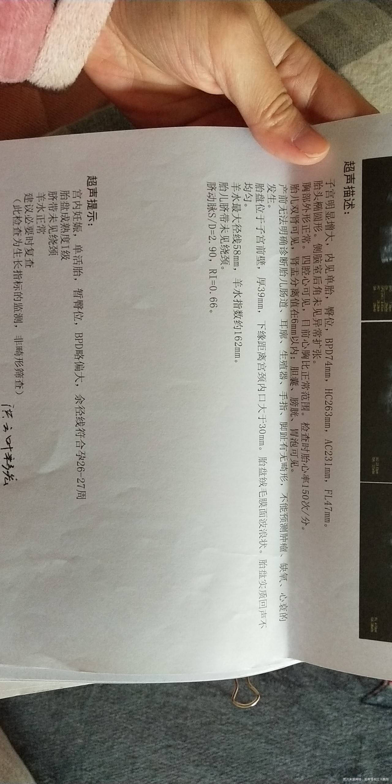 怀孕27周昨天复查B超写的胎盘绒毛膜面波浪状