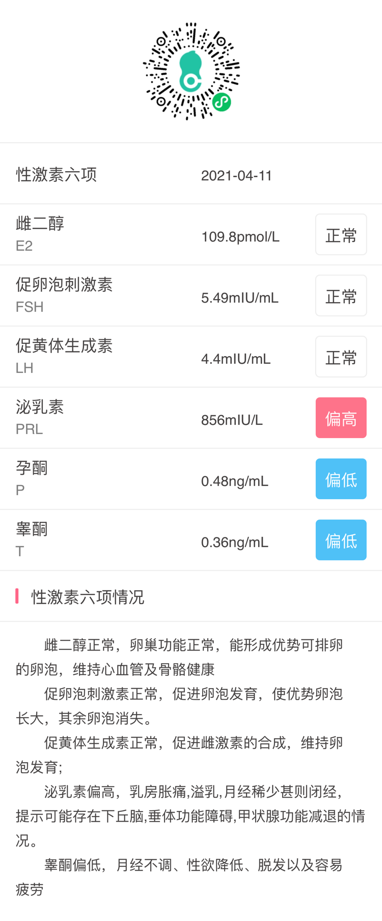 月经量少垂体泌乳素高