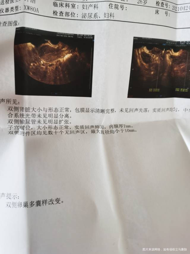 长期月经稀少有半年未来经过吃益母草片后来了2