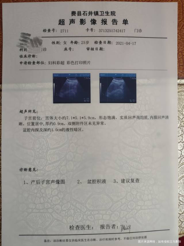 产后42天抛妇产42天母乳喂养下身见红是恶露