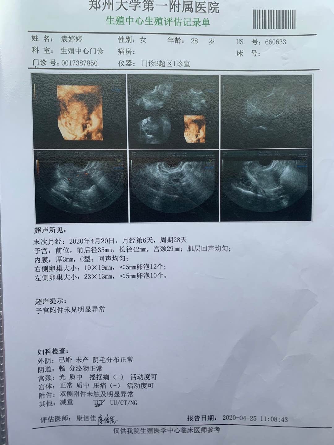 这种B超结果属于多囊卵巢吗