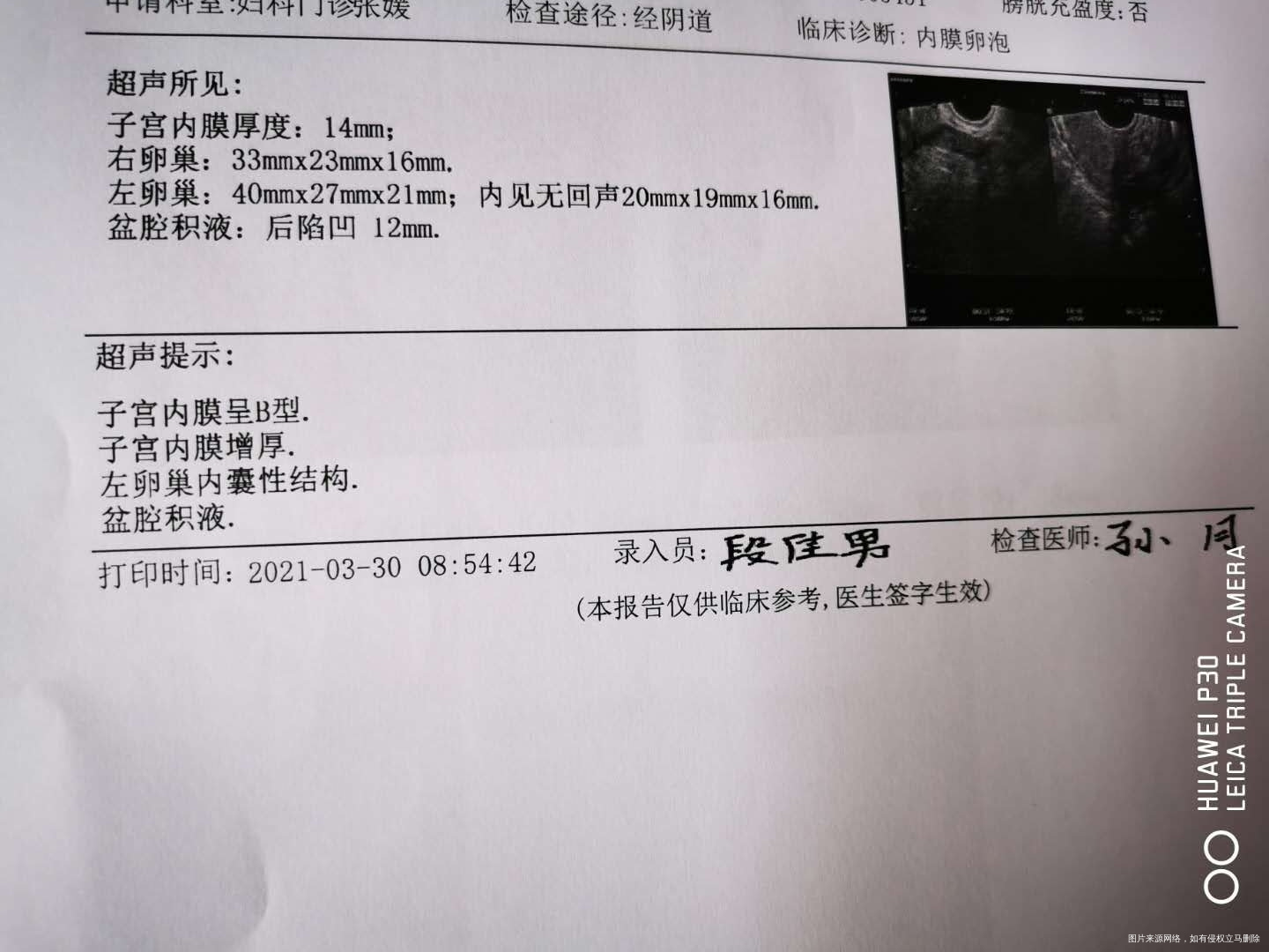 性激素六项雌二醇偏低卵泡发育慢