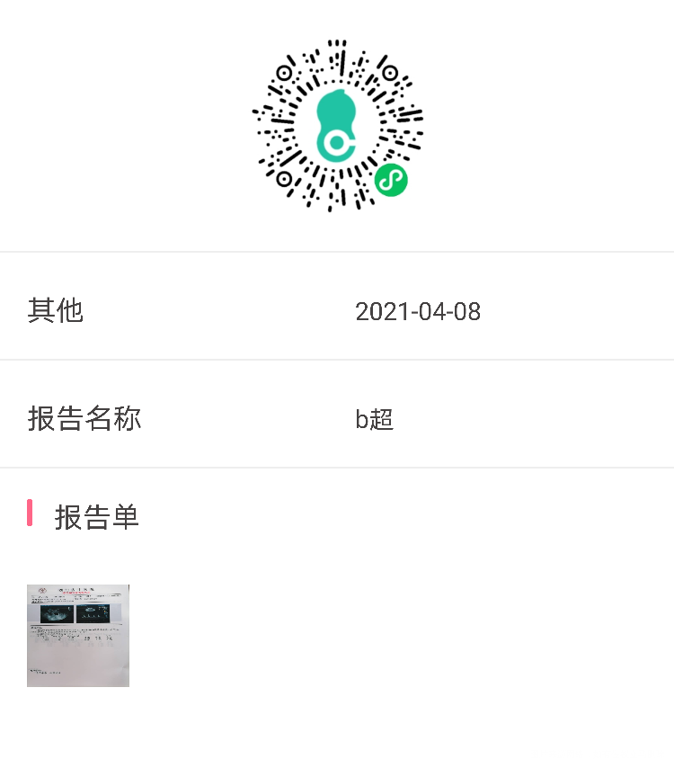 在孕七周胎停过一次这次怀孕在孕6周左右查的子