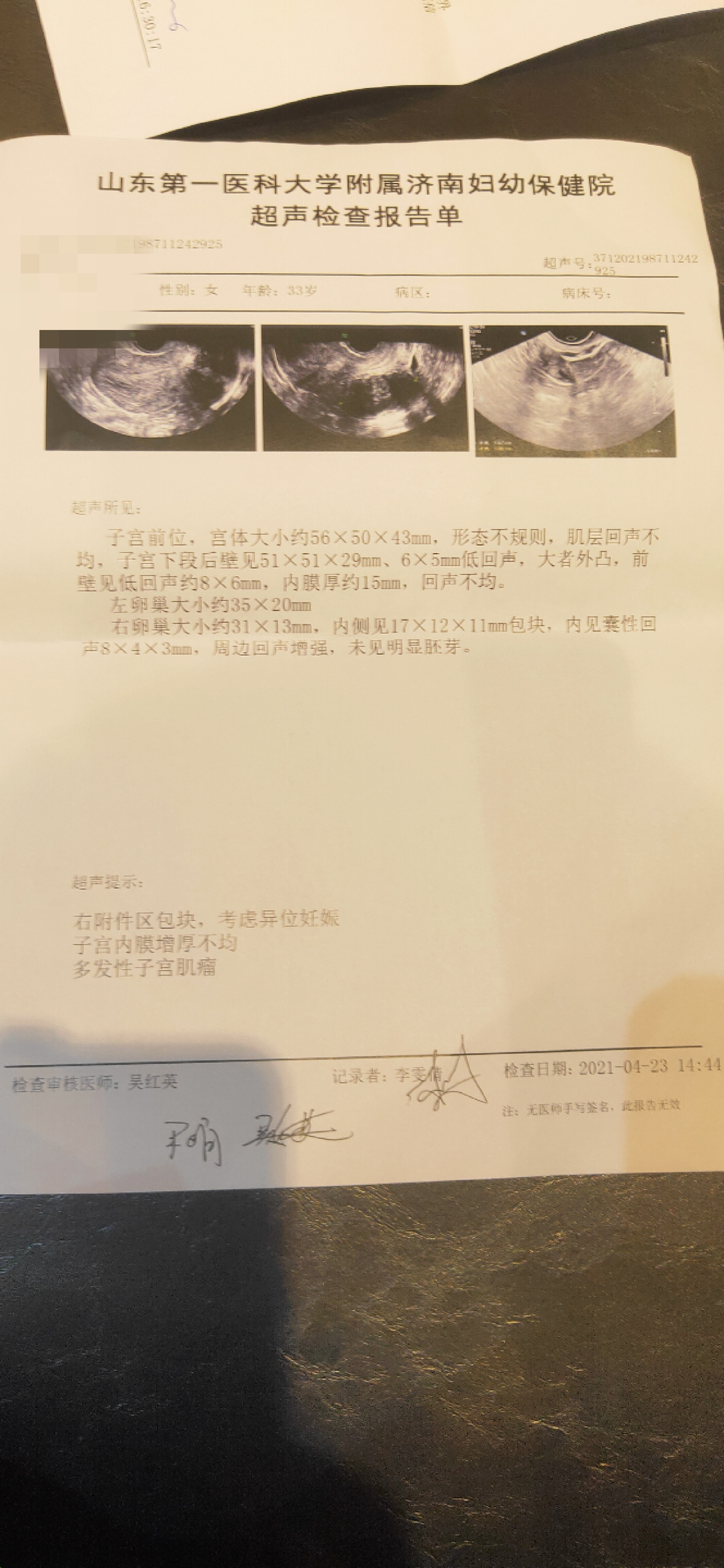 宫外孕还有一个子宫肌瘤请问腹腔镜可以做掉子宫