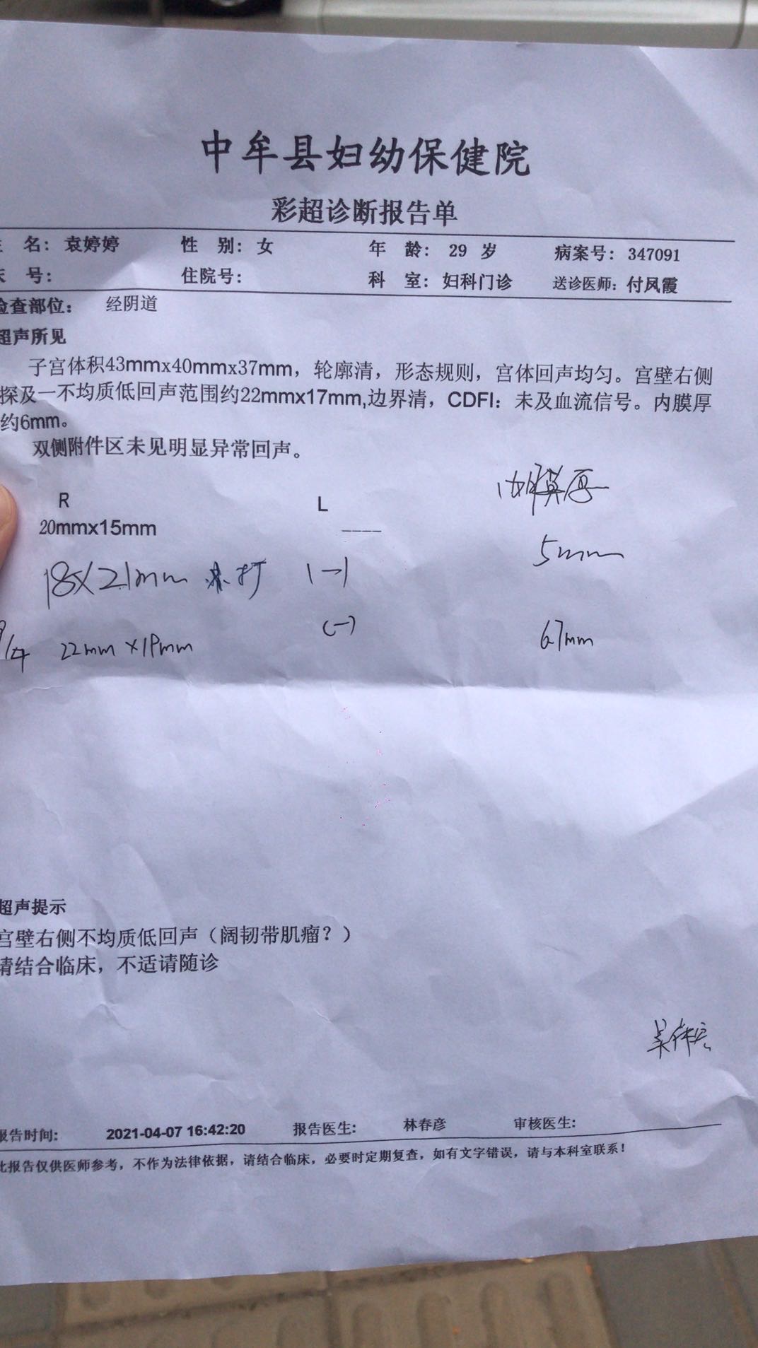 今天月经第12天麻烦大夫给看一下这个月卵泡发