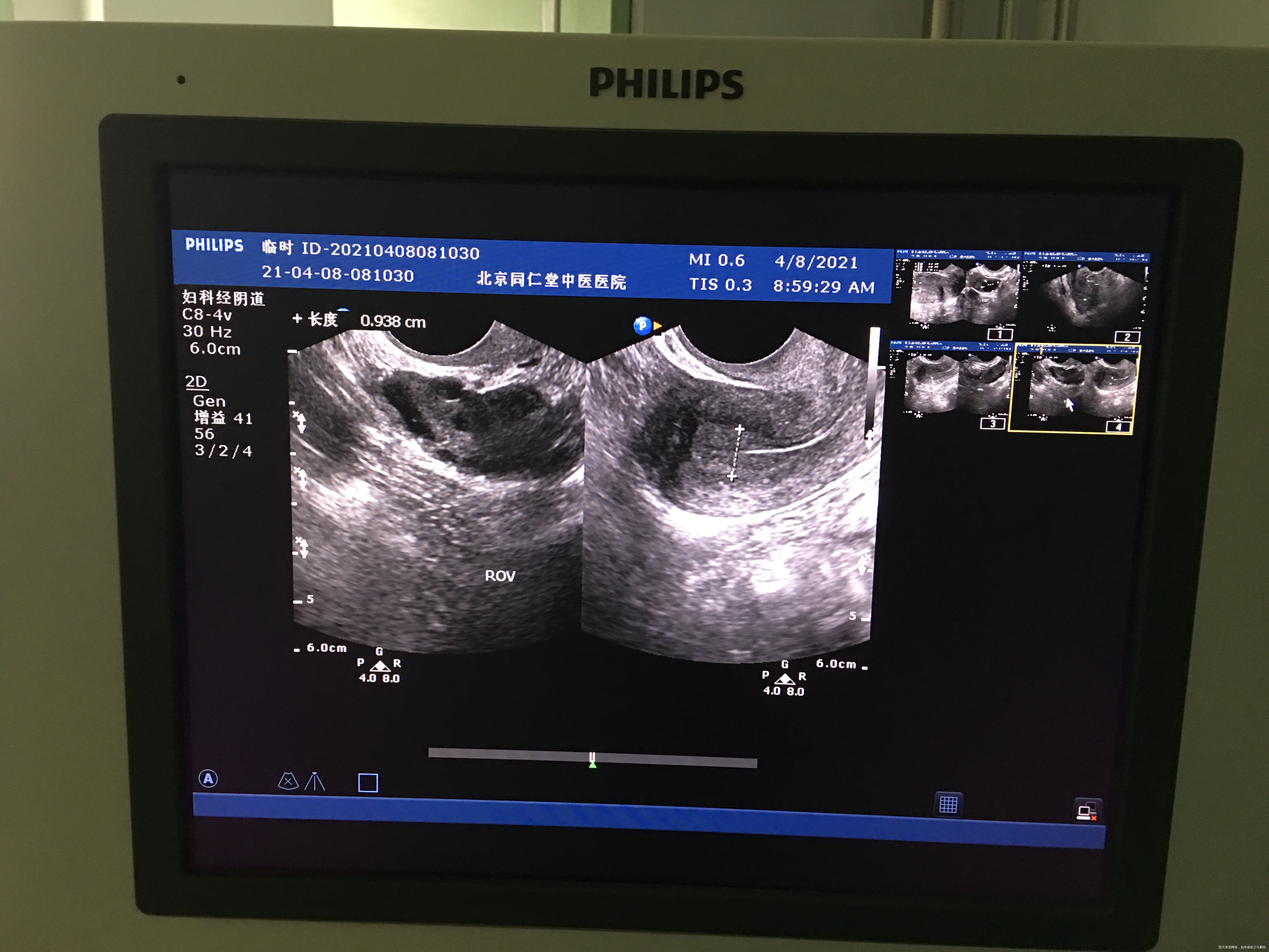 您好我月经不规律上次月经3月2日请问我现在这