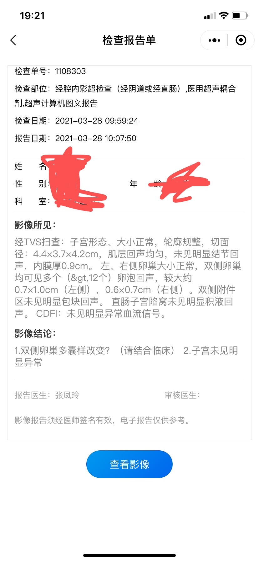 多囊吃了4个月达英测到激素正常后就停药了但是