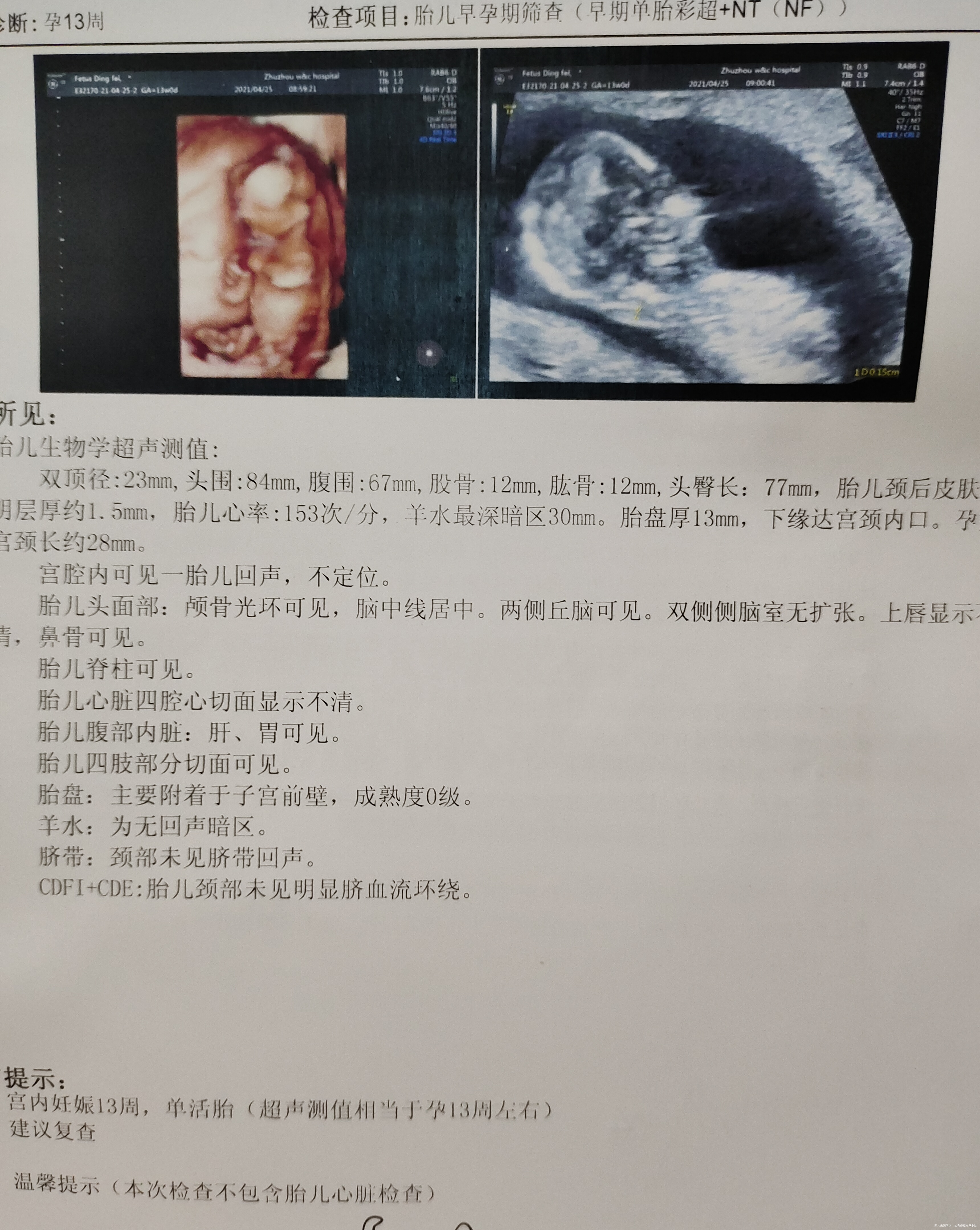 想问彩超结果有异常没然后唐筛那个能不能等中期