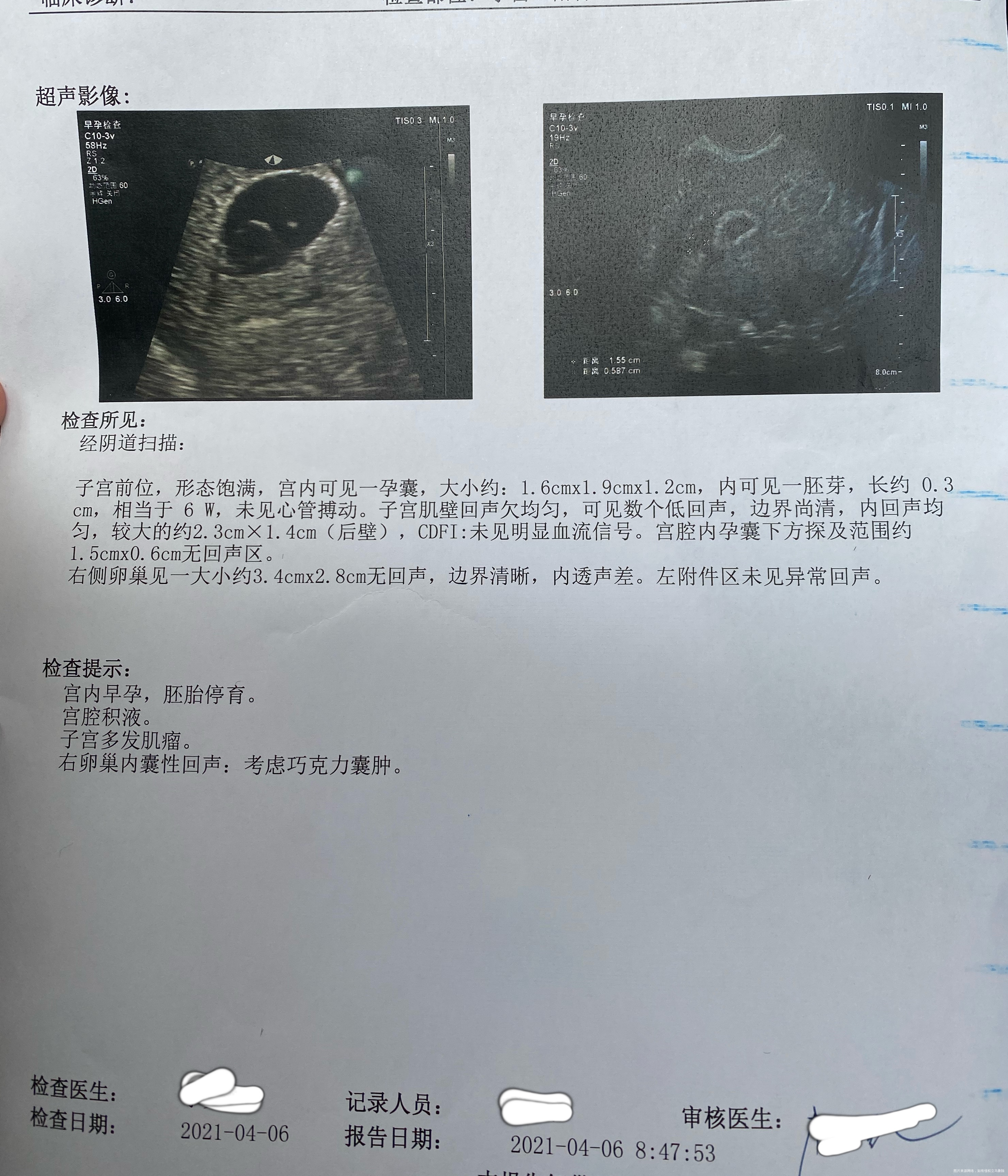 医生晚上好我是2月1日末次月经第一次自怀HC