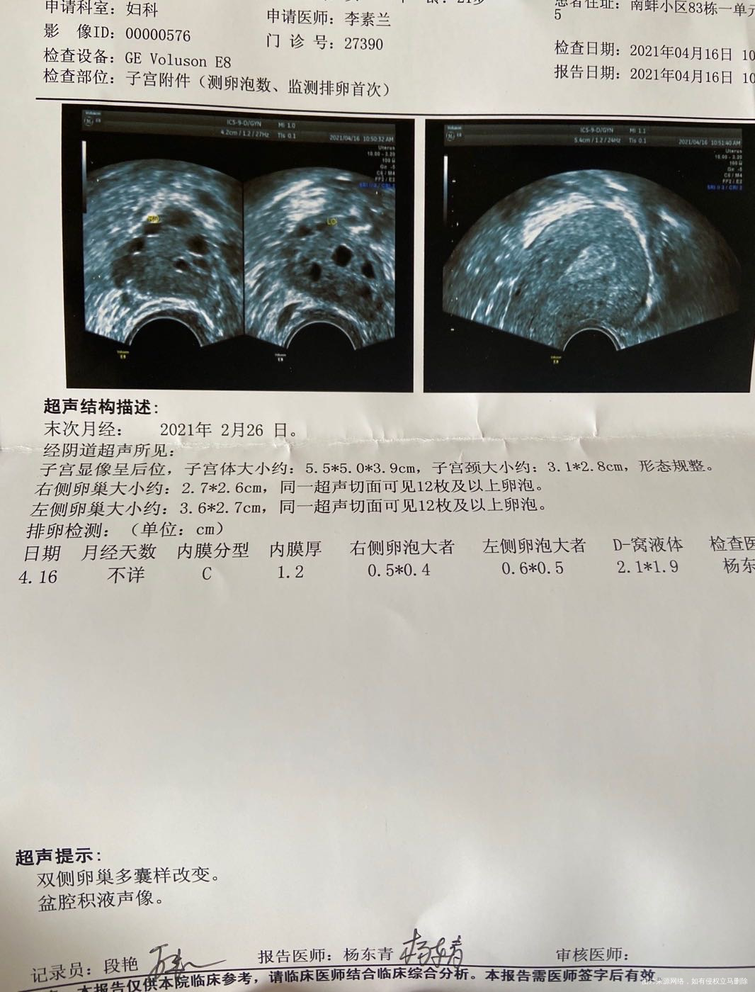 多囊内膜12了然后开始吃地屈孕酮片今天第6天