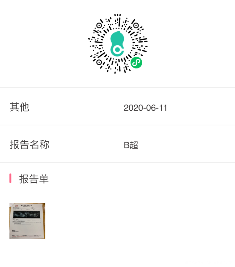 我想知道这个月有可能怀孕么