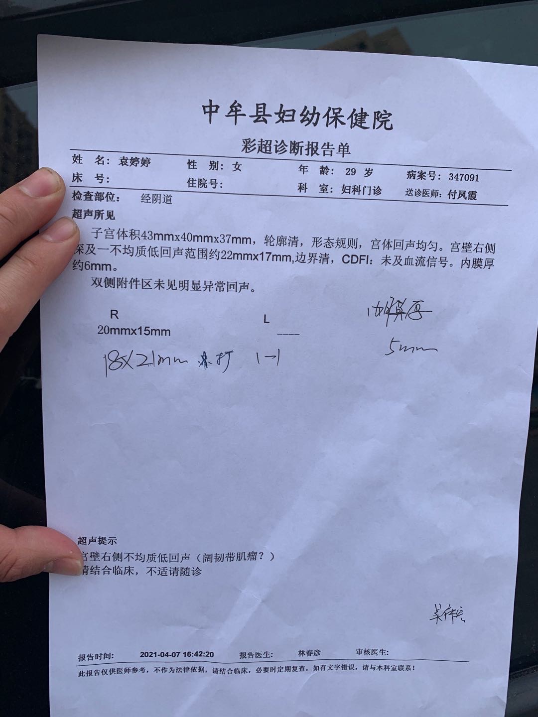 月经第五天服用来曲唑5天月经第10天测卵泡2