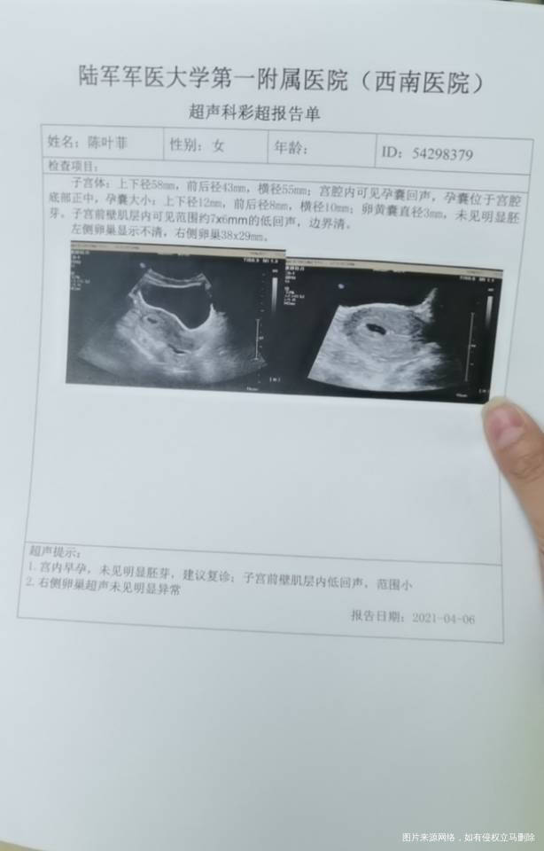 2月24日来的例假3月26日出了一点点血很少