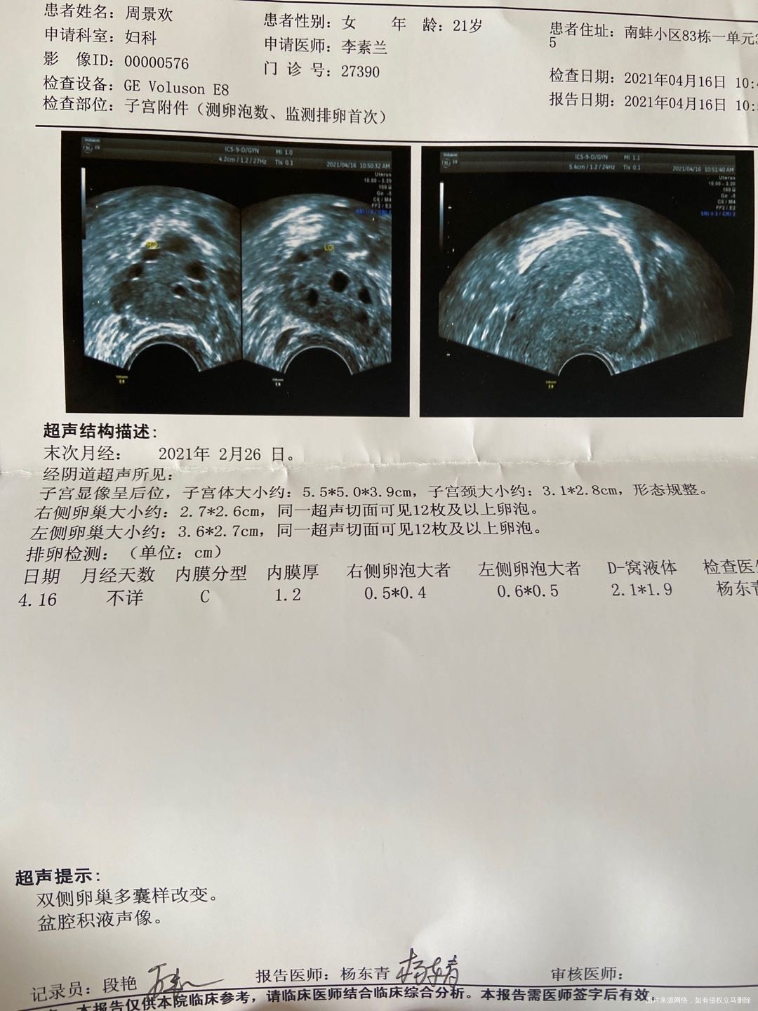 多囊最后一次月经2月264月16检查内膜12