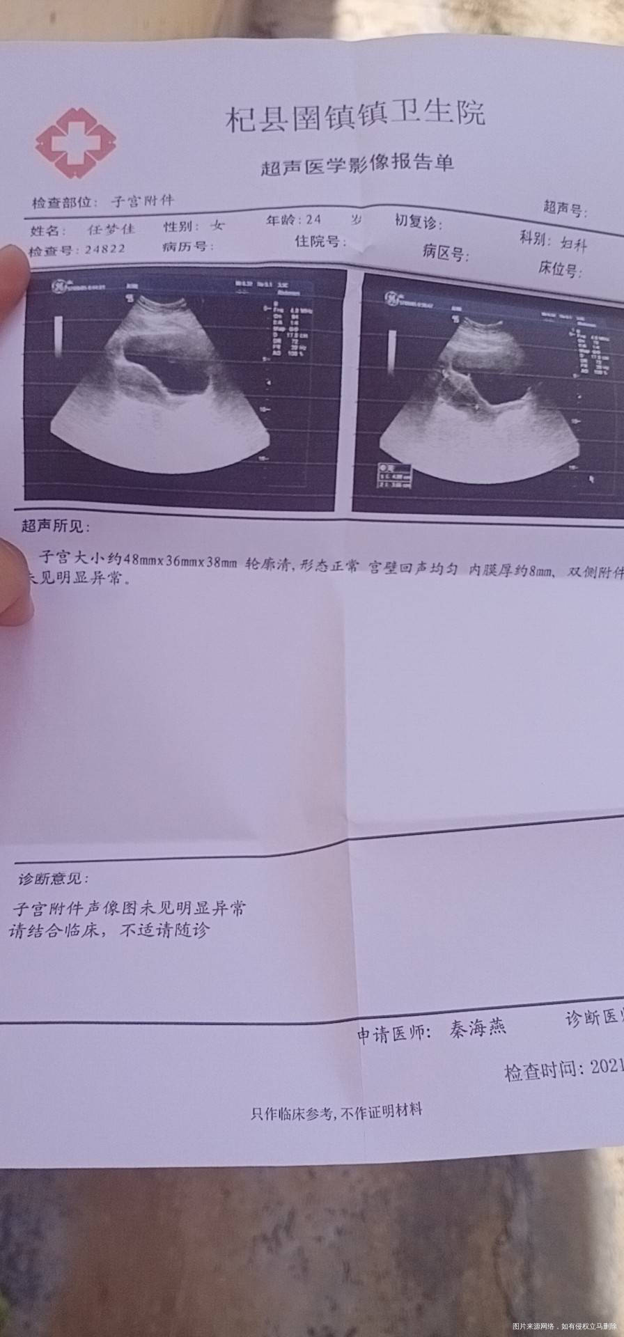 监测卵泡月经周期第11天12×8第13天13