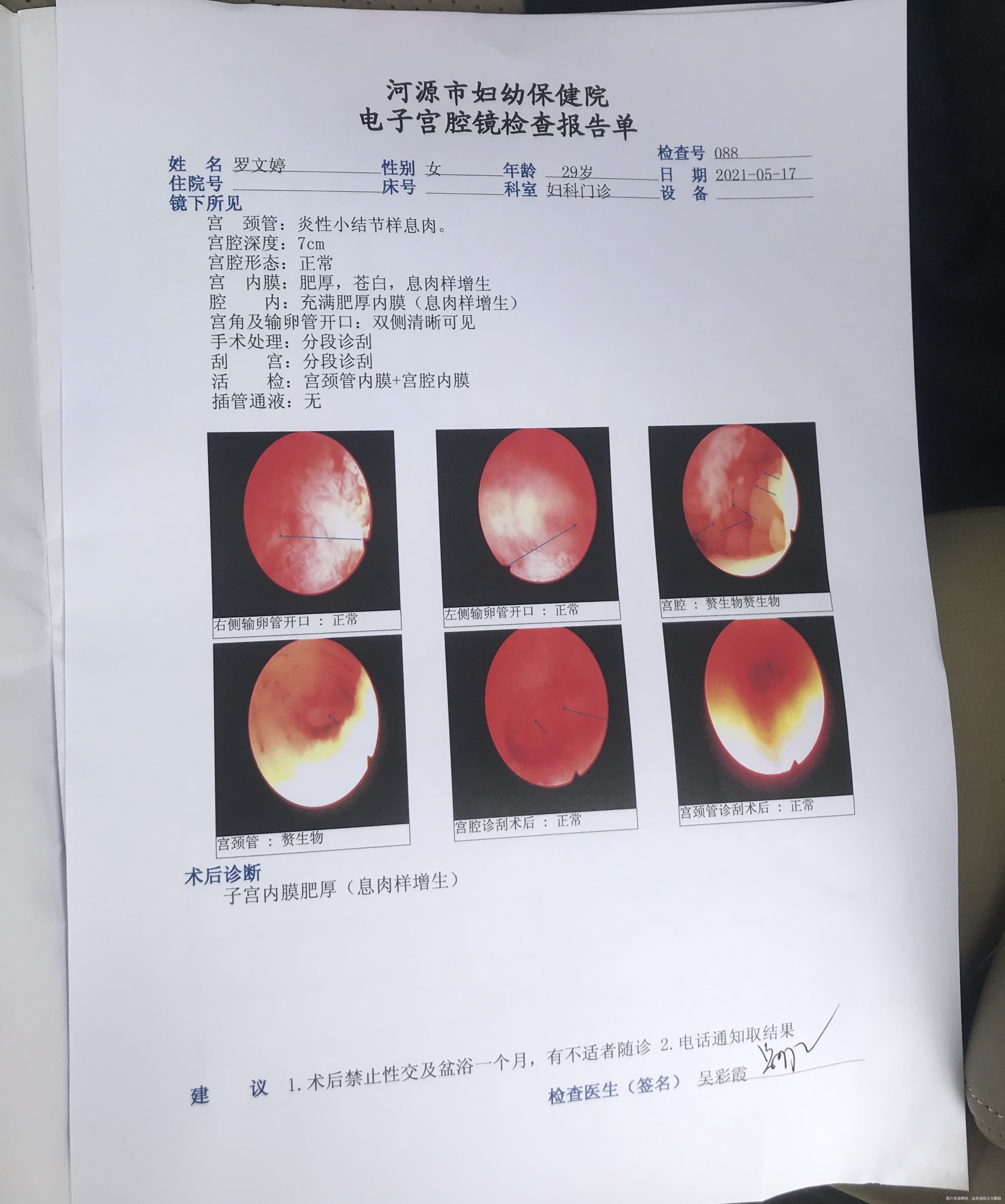 一年前开始来完姨妈一个星期多就开始不规则流血