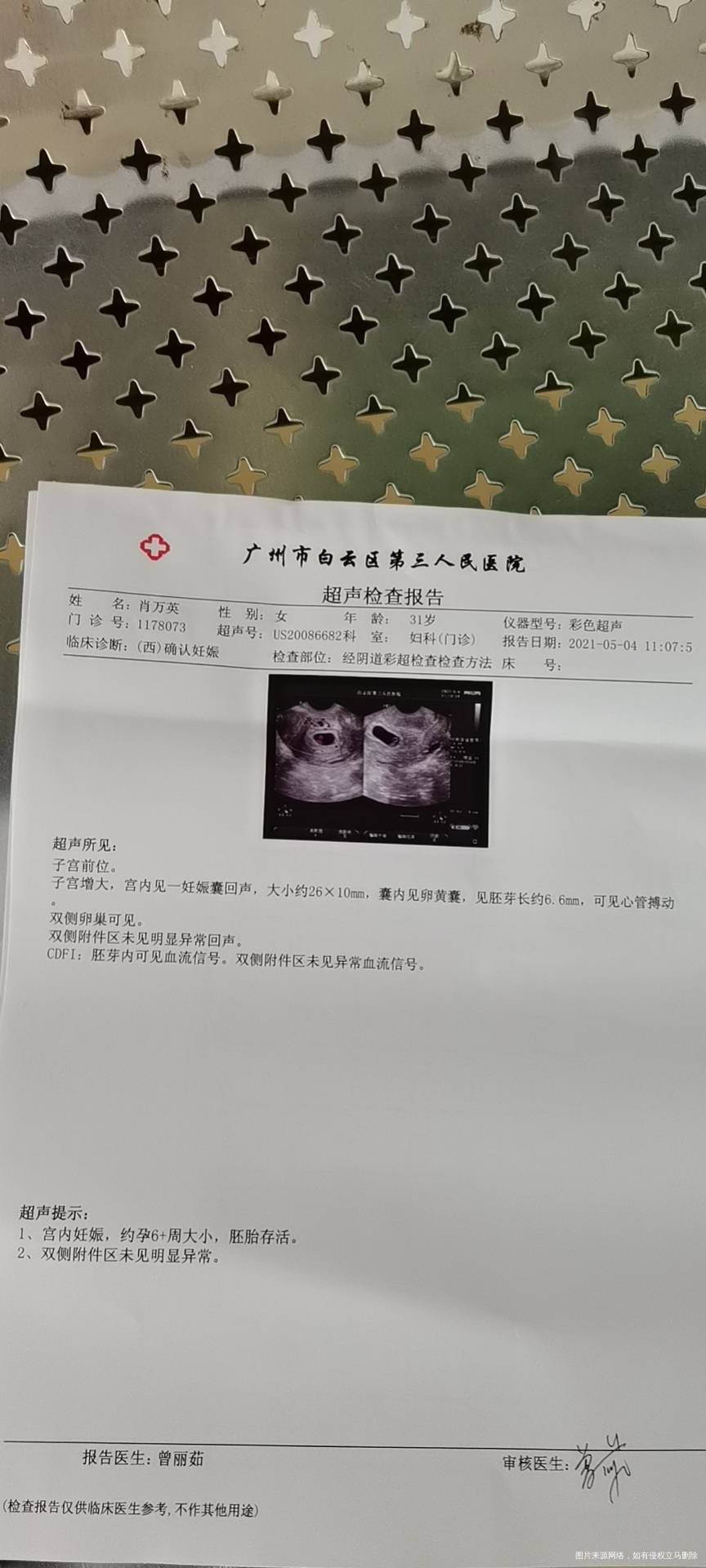 你好医生我已怀孕46天昨天照阴超已有胎芽胎心