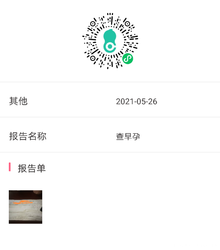Bhcg值28是怀孕了吗