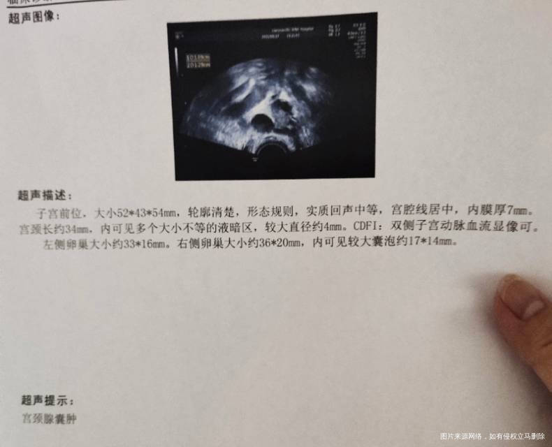 第三次促排月经第九天上午卵泡13mm内膜6m