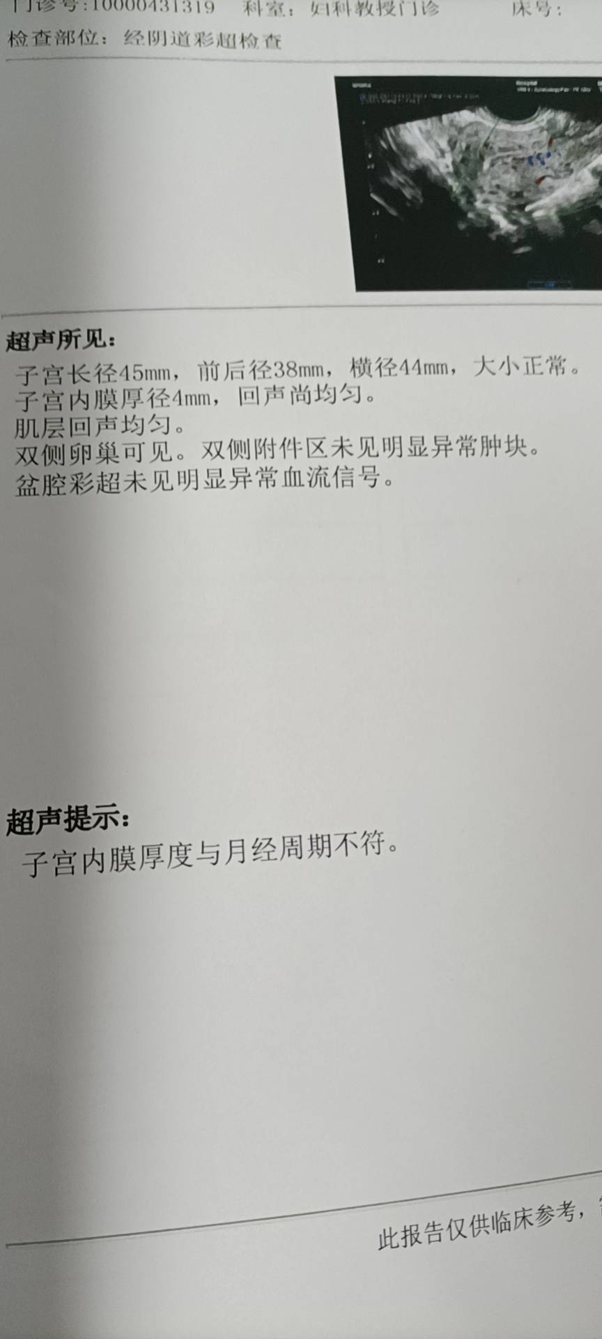 请问来月经第15天内膜怎么才4毫米呢我每天有