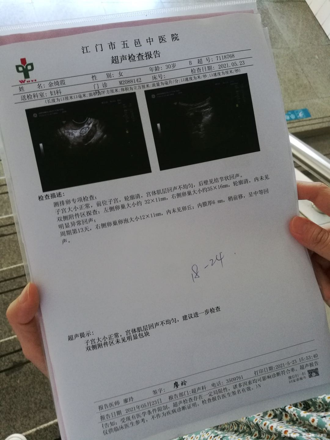 511517月经期平时周期2526天排卵试纸