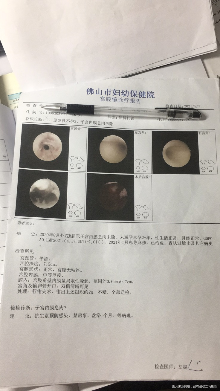 我2021年5月7日做宫腔镜手术做完直接回家