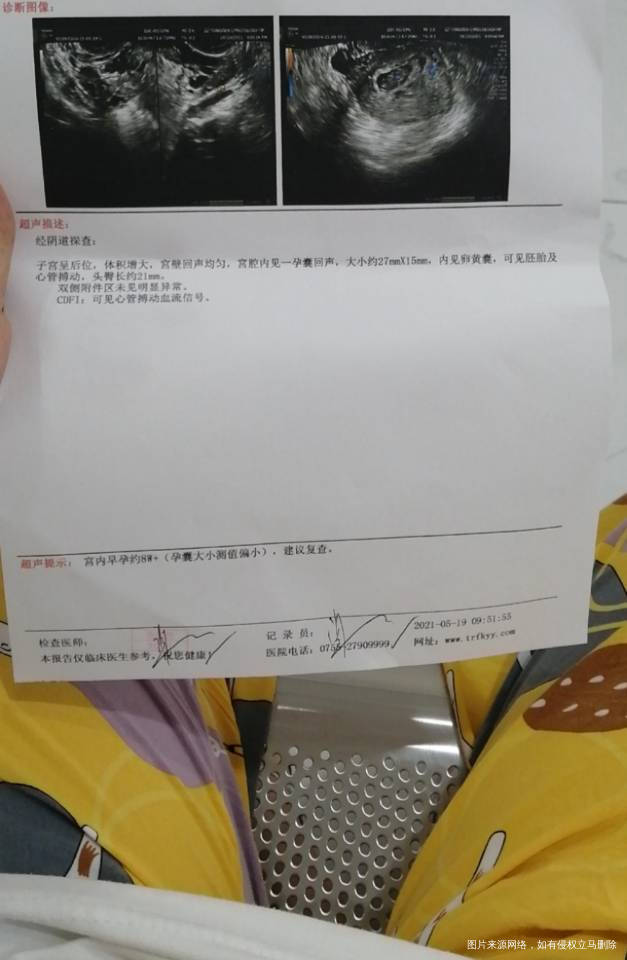 医生你好帮我看看b超单b超单上说孕囊偏小严重