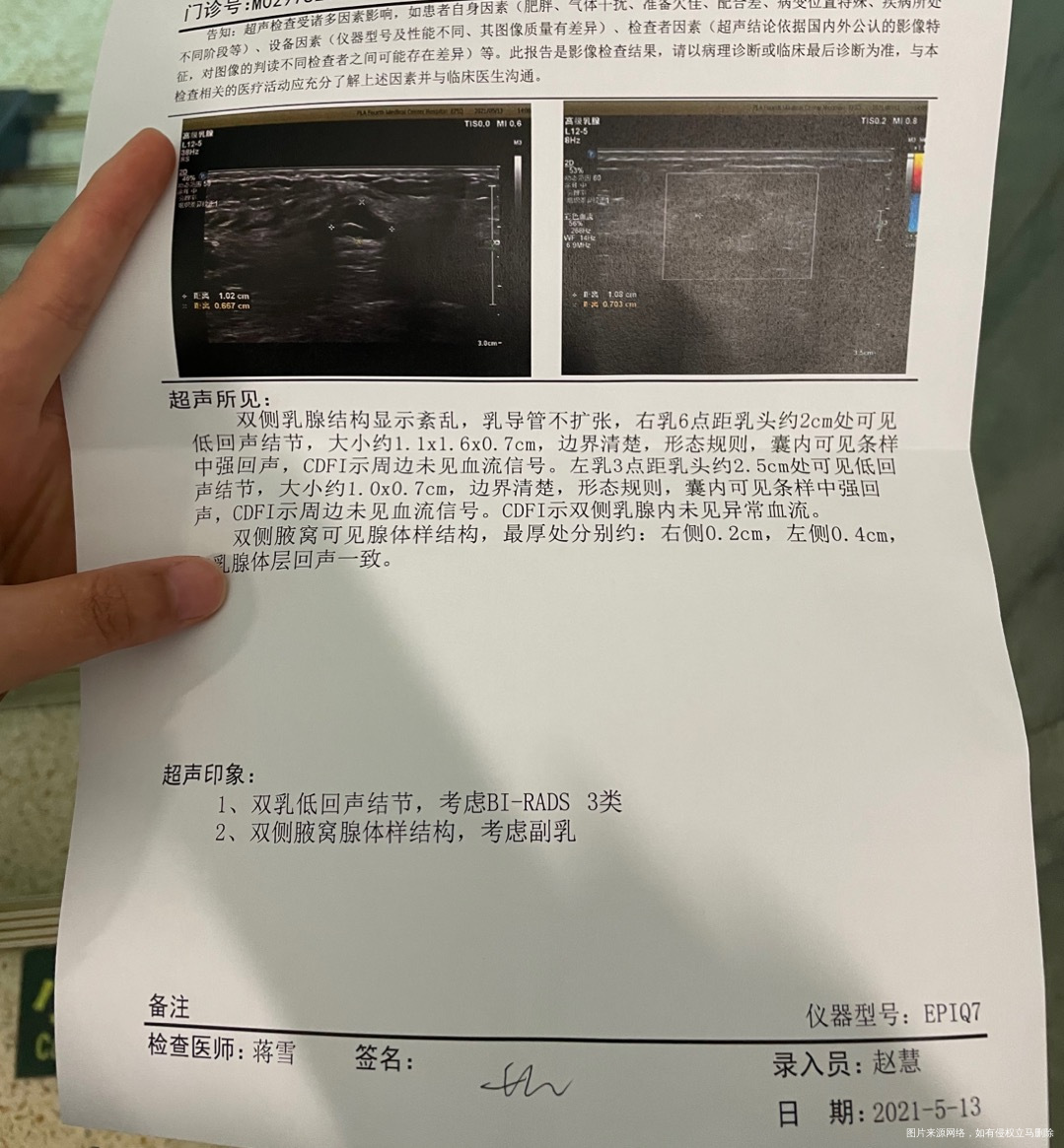 打算做人授检查的乳腺结节三级会有影响吗