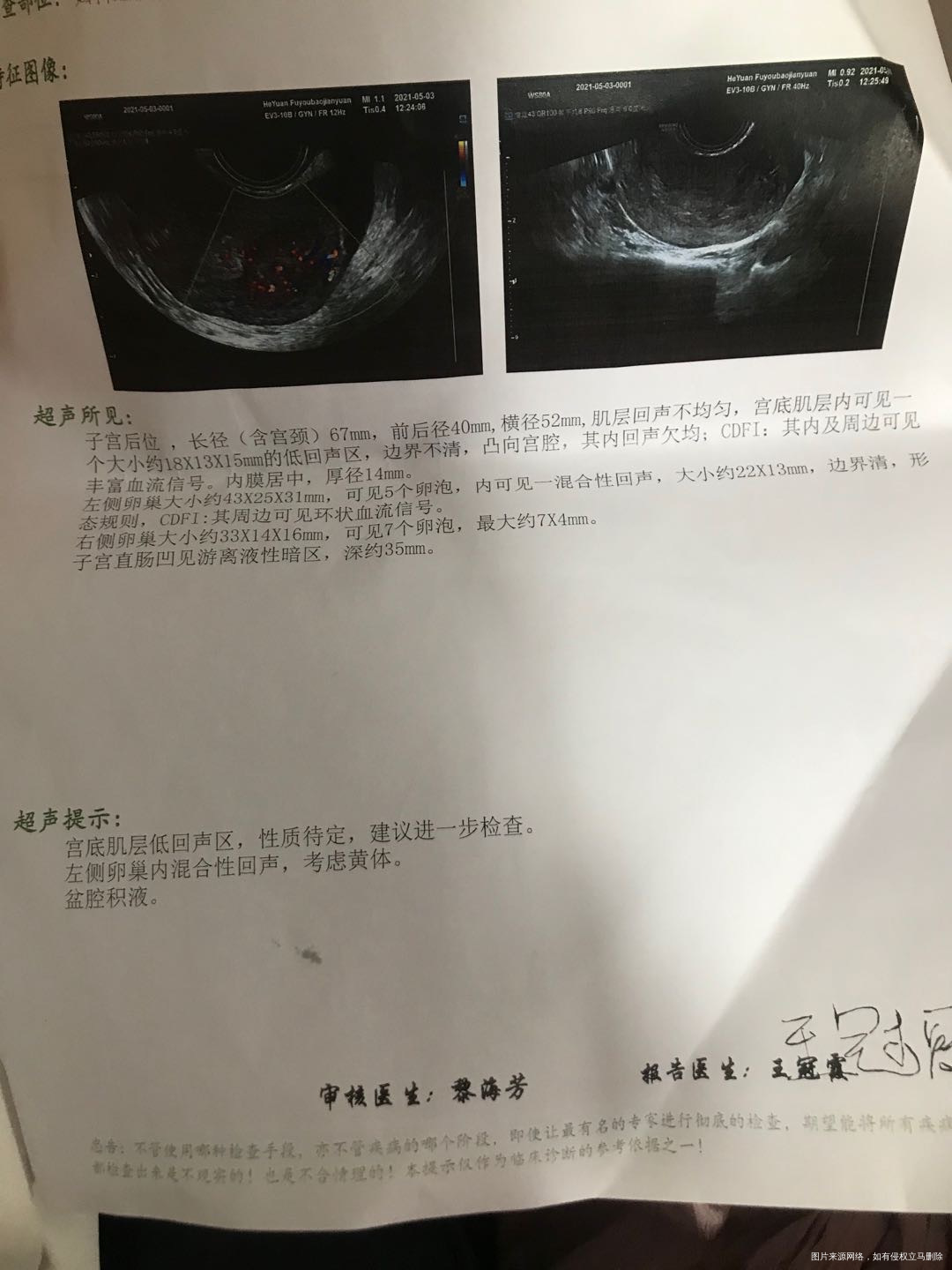 一年前开始来完姨妈一个星期多就开始不规则流血