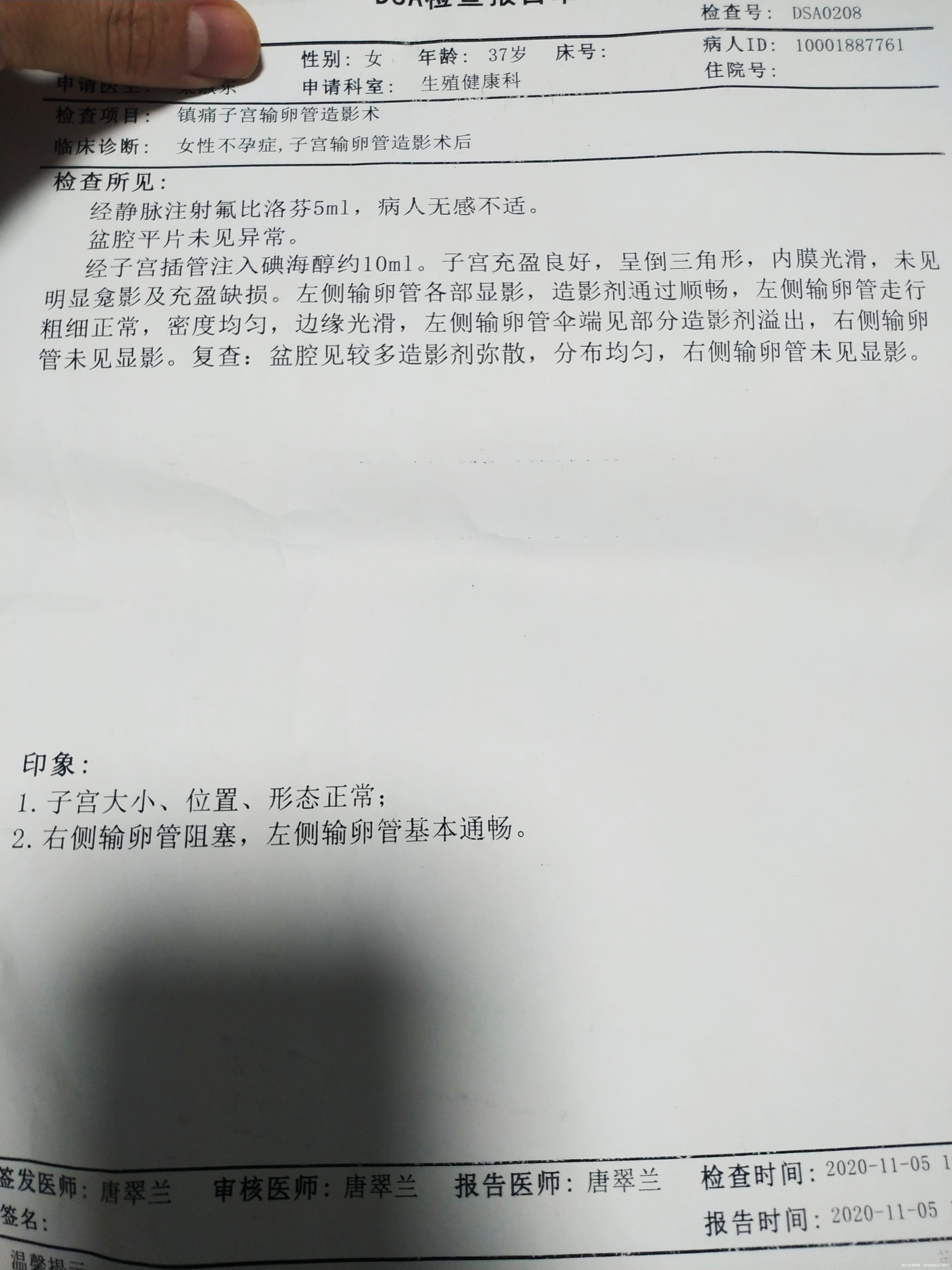四年没避孕但一直没怀上28岁自然怀孕顺产一男