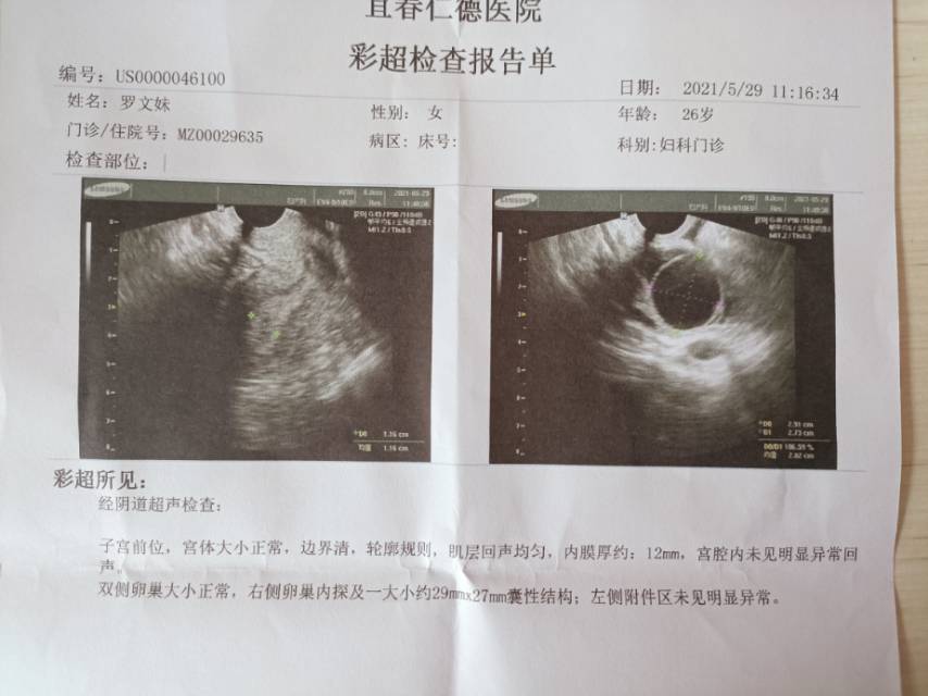 医生您好我每次都月经推迟大慨周期45天有一年