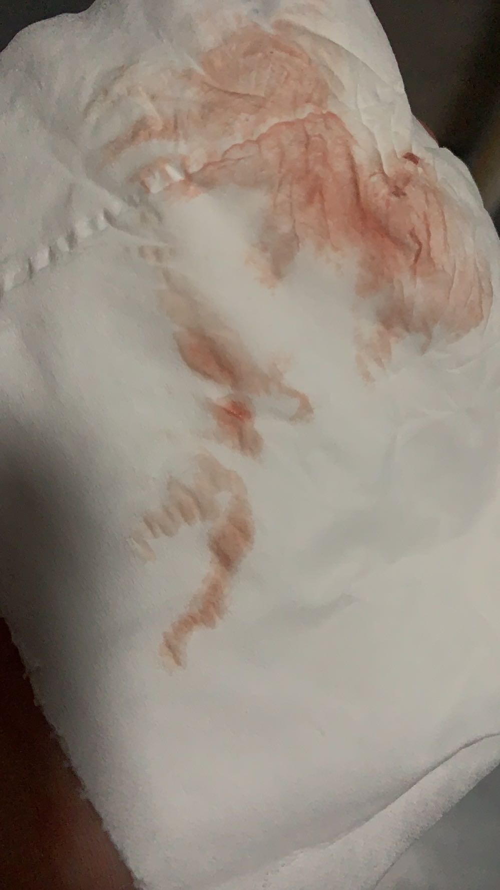 48日末次月经排卵推迟8天伴有出血