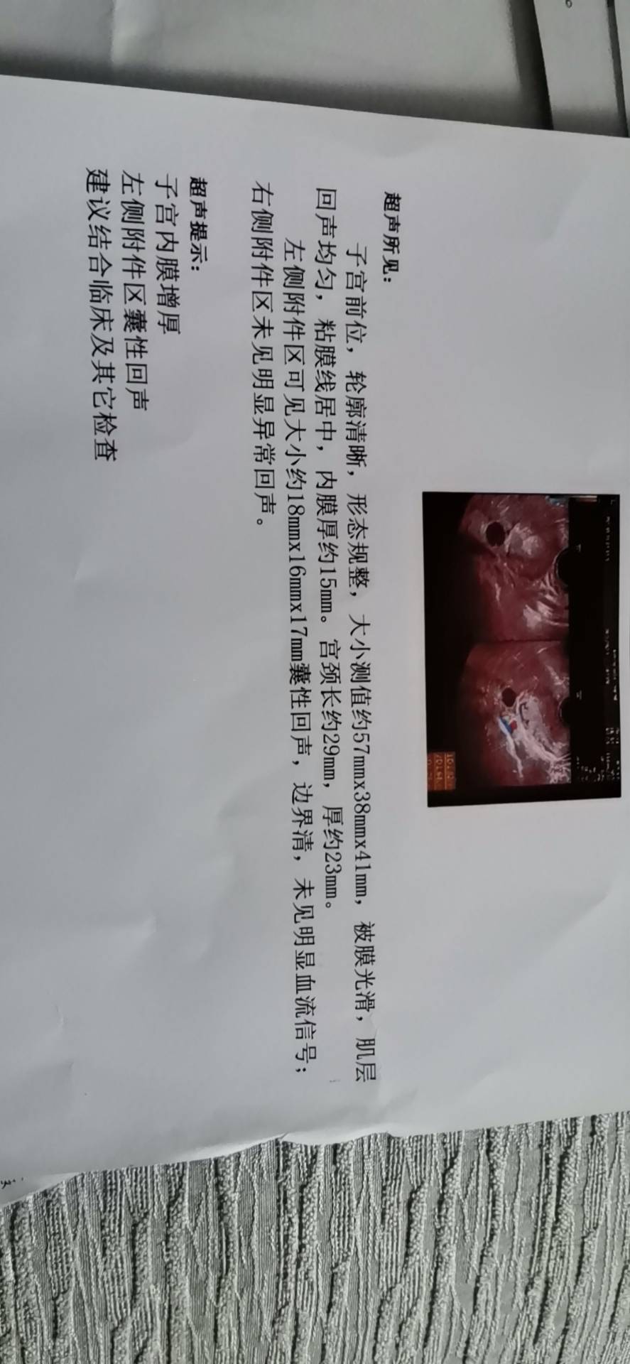 月经干净第五天做的检查内膜厚怎么办左侧卵巢那