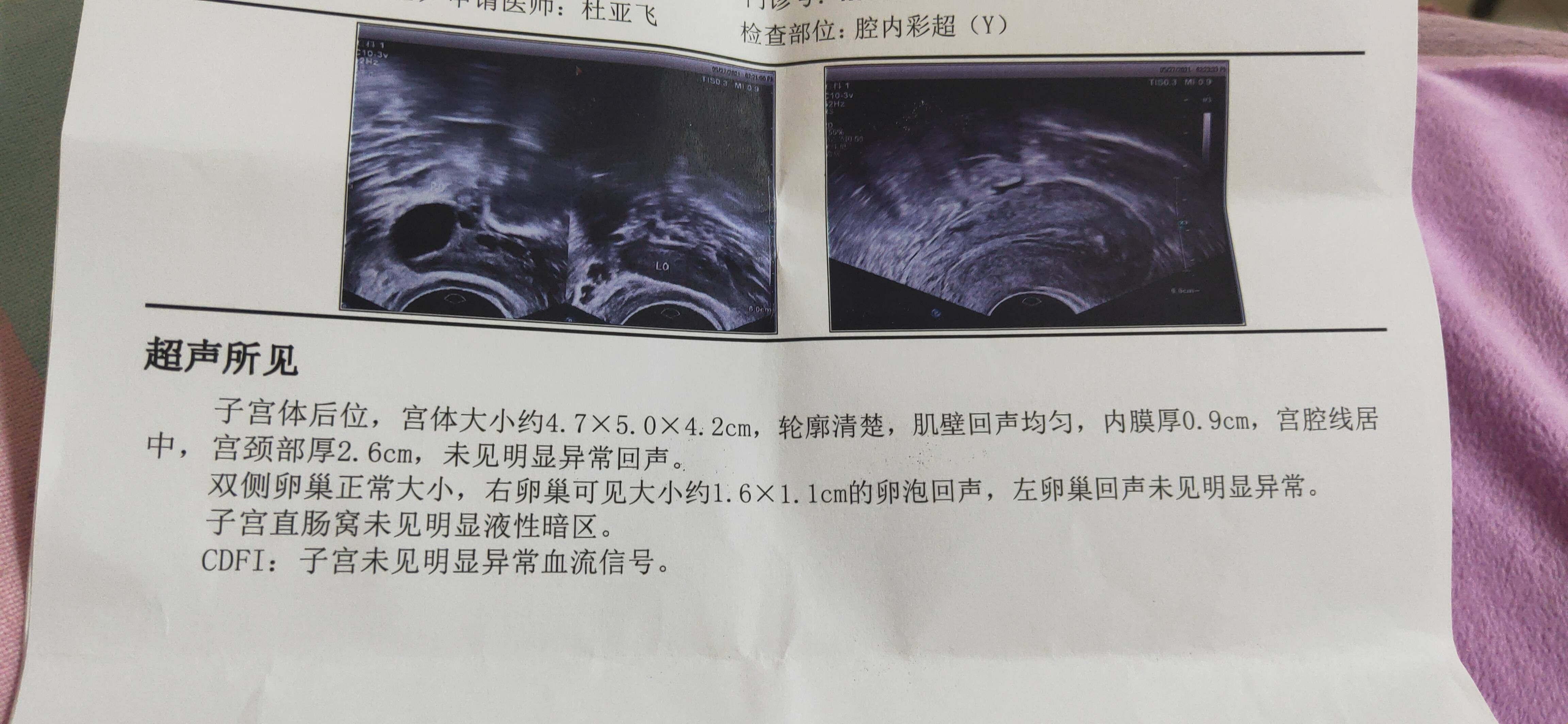 之前生化过现在排卵期这个卵泡和内膜怎么样还需