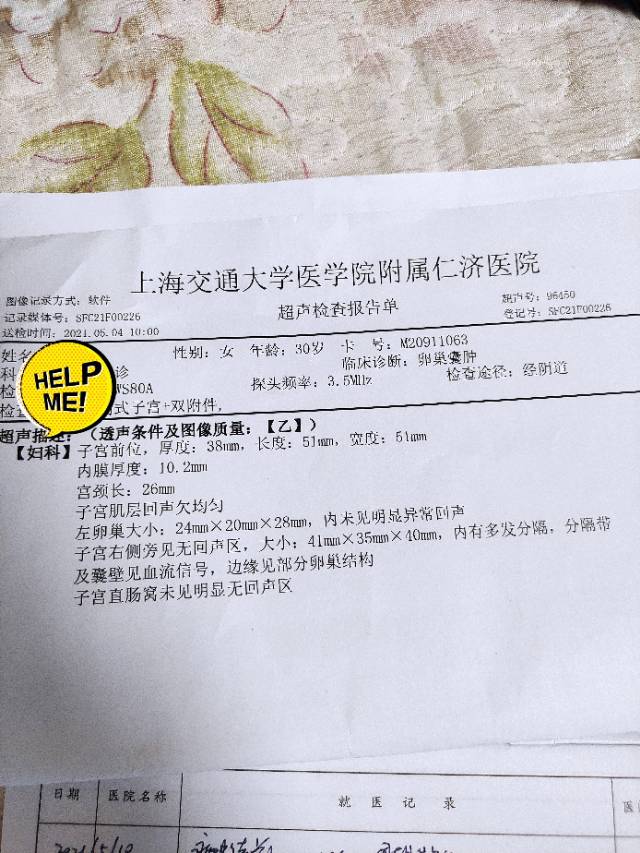 我一直有慢性宫颈炎白带黄色脓性也一直右侧有卵