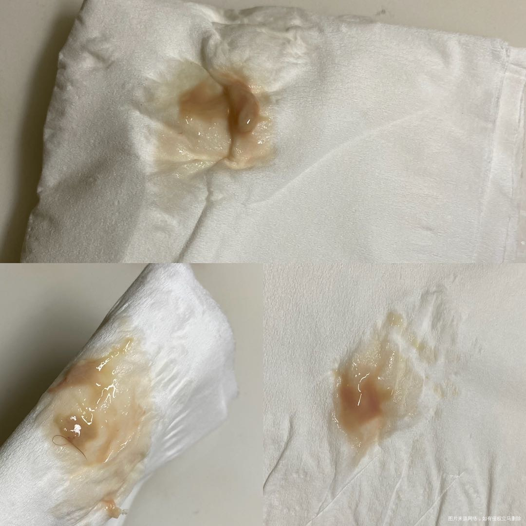 目前怀孕19周2天晚上上厕所出现这种分泌物是