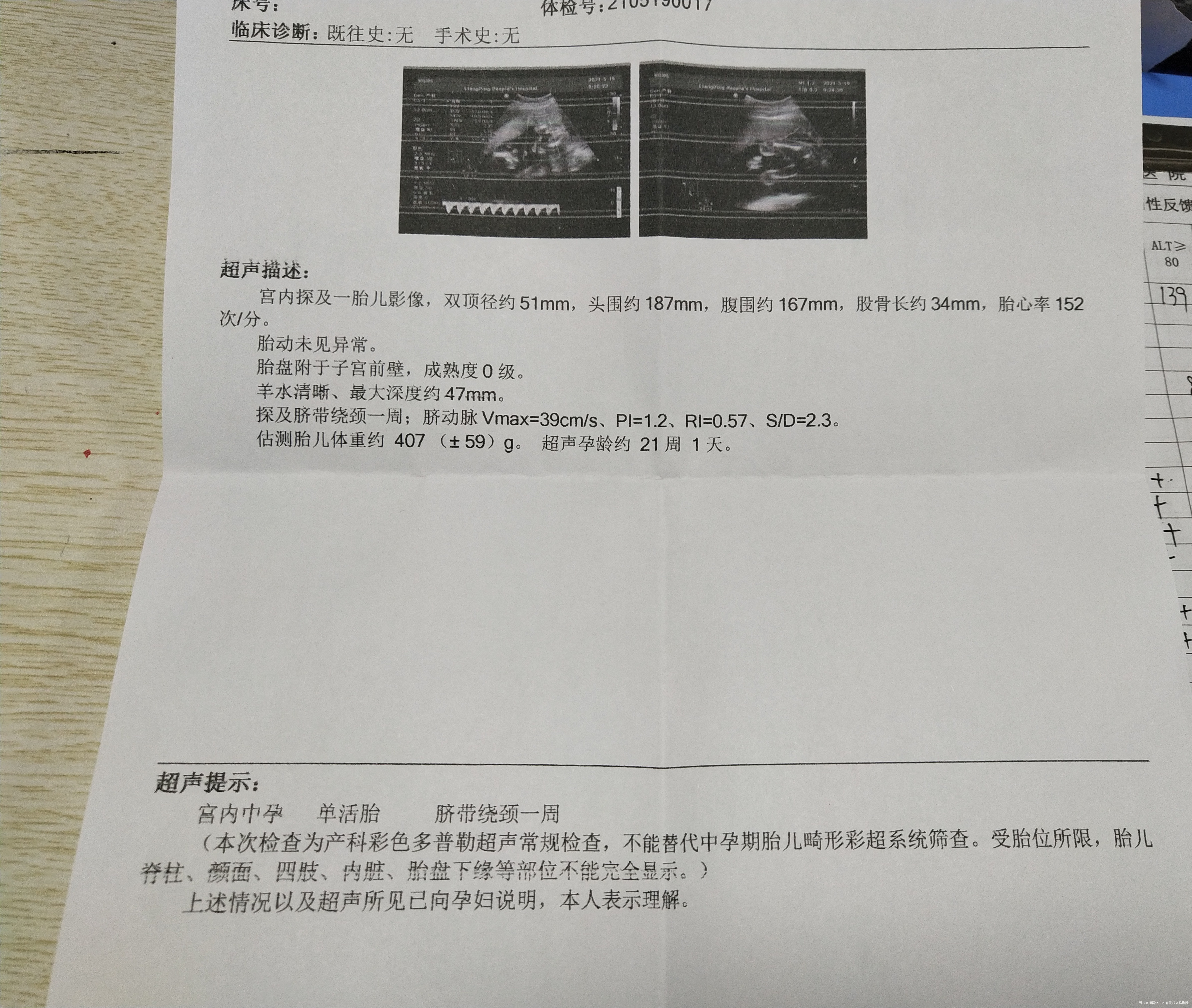 医生你好麻烦帮我看看我这个彩超我519号早上