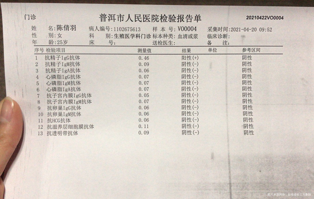 请问医生别的检查都没发现问题抗精子抗体这一项