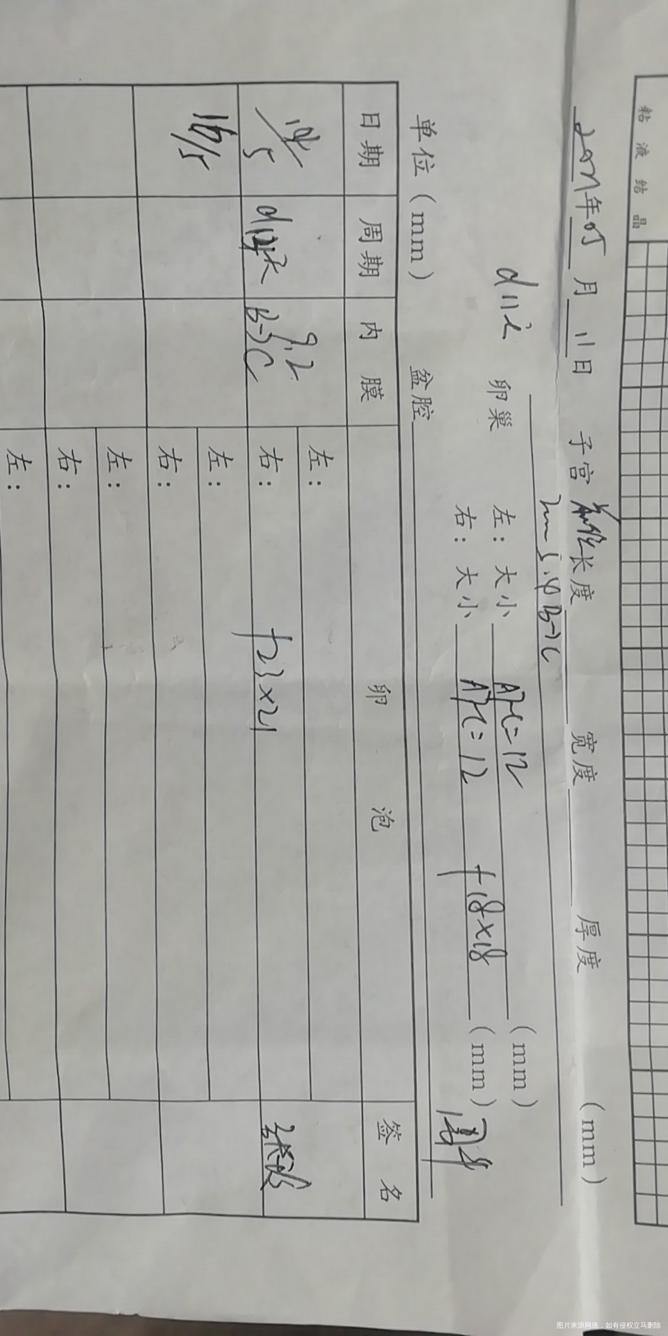 请问大家511监测右侧优势卵泡1818514