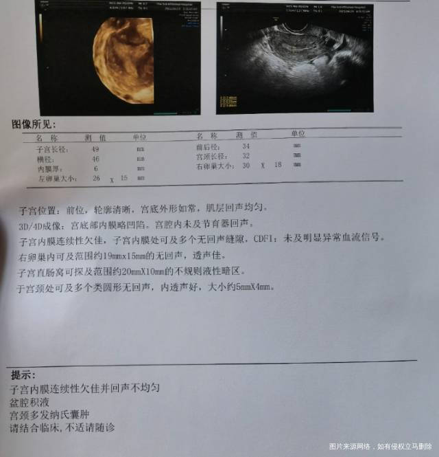 备孕1年从来没怀过在当地二甲医院做了输卵管自