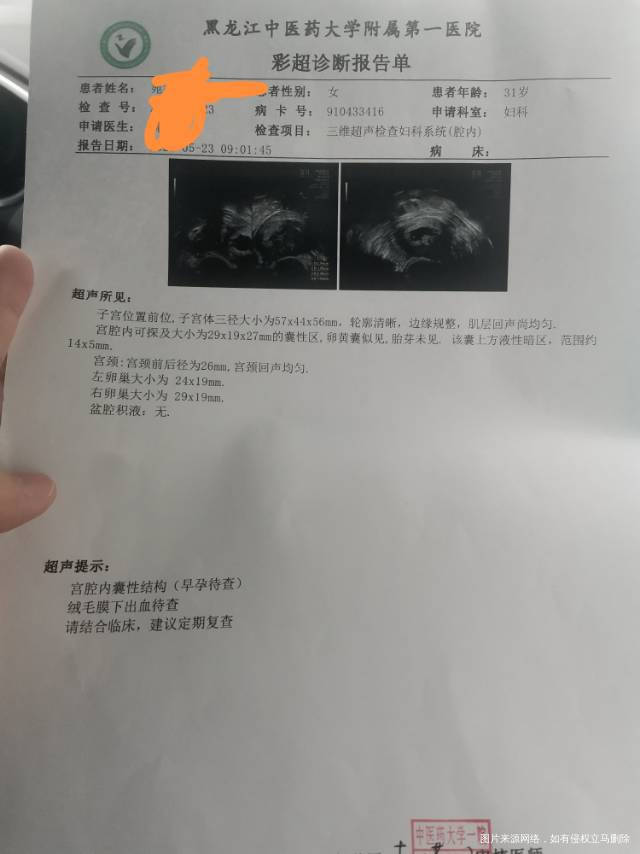 还有保胎的必要吗我害怕葡萄胎