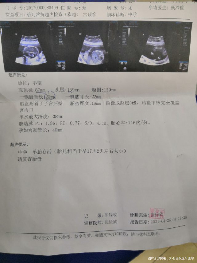 怀孕5个月羊穿唐氏综合征目前无孩引产是顺产还