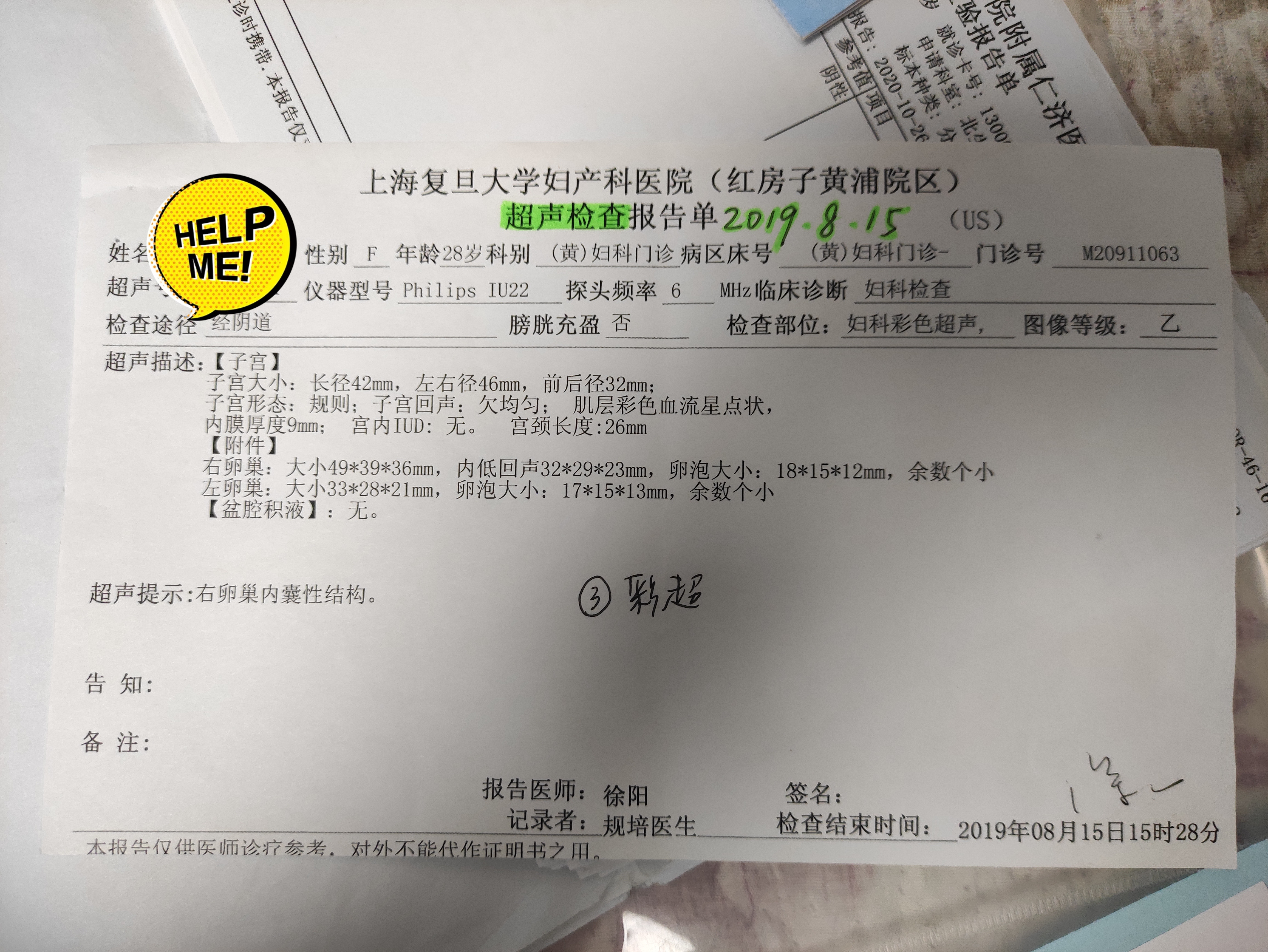 我一直有慢性宫颈炎白带黄色脓性也一直右侧有卵