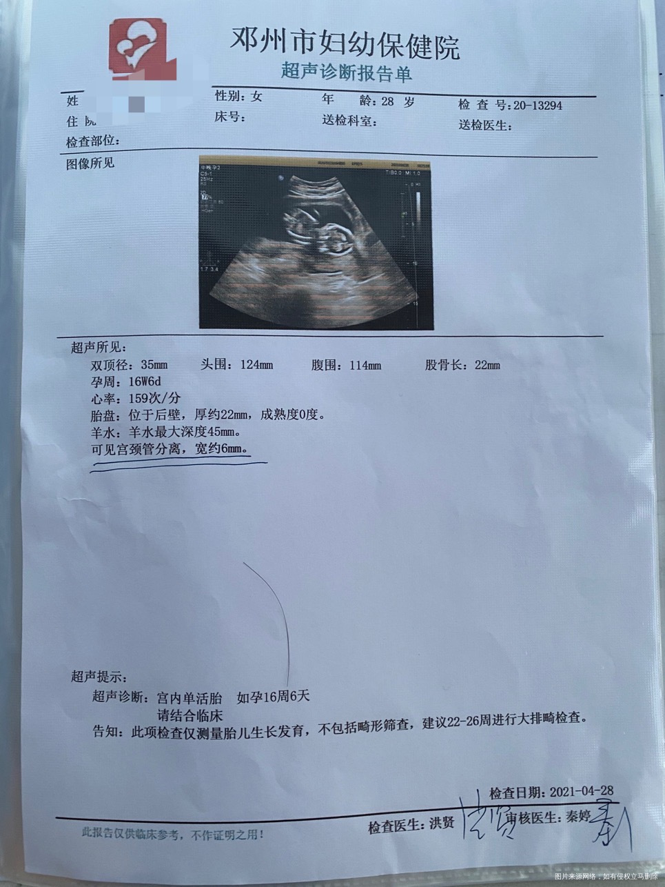 目前怀孕19周2天晚上上厕所出现这种分泌物是